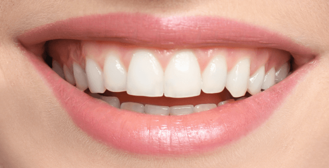 Zuby po bělení s proužky Crest 3D White Professional Effects