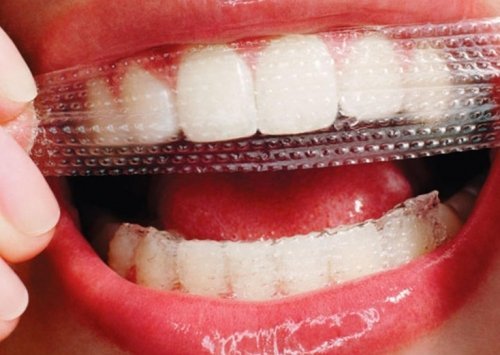 Bělení zubů páskem