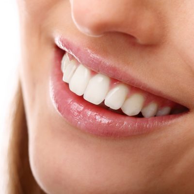 Úsměv s bílými zuby